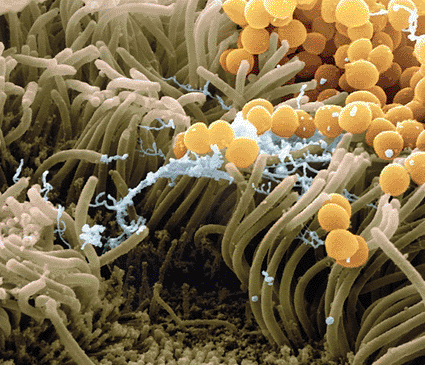Image: Colored scanning electron micrograph (SEM) of Staphylococcus aureus bacteria (yellow) on human nasal epithelial cells (photo courtesy Juergen Berger / Science Photo Library).